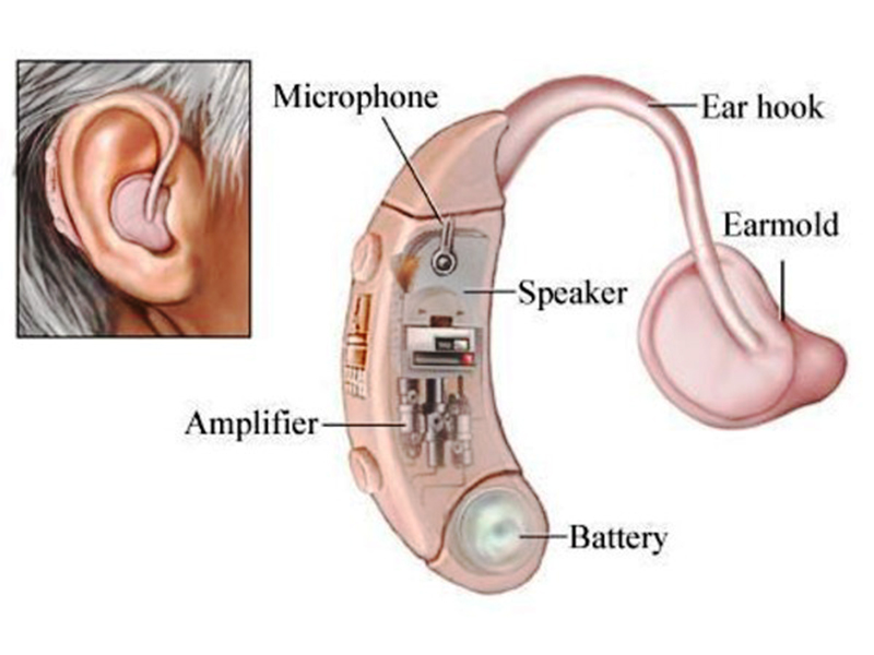 how hearing aids word to help hearing loss people receive the sound.jpg