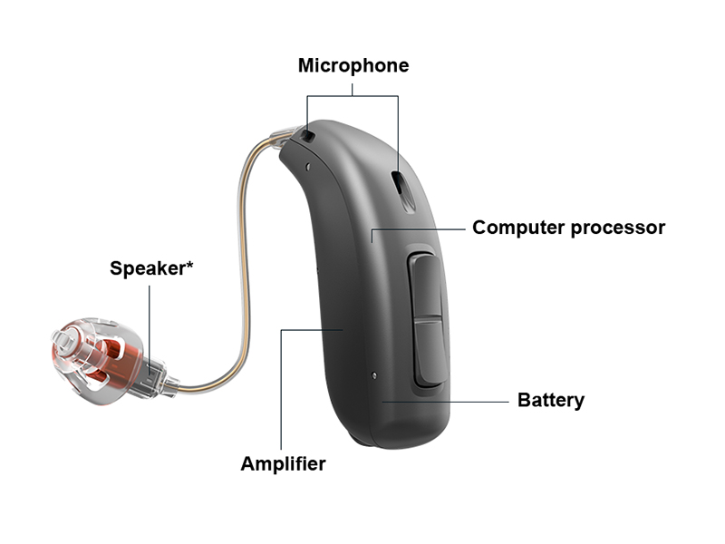 text-image-spot---a-look-inside-a-hearing-aid-936x665.jpg