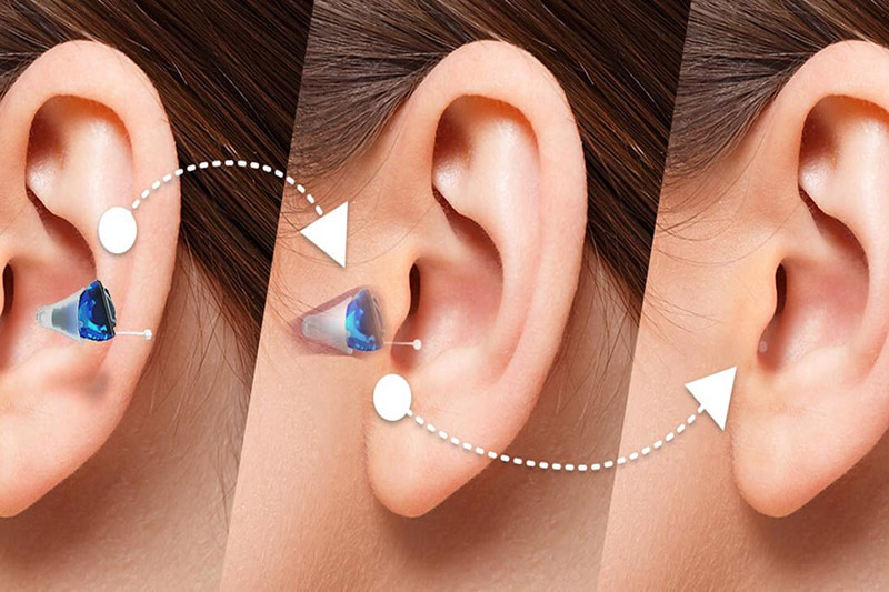 completely-in-canal-hearing-aid-wear-steps.jpg